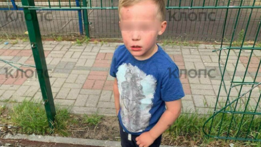 Мама бьет тревогу: в Калининграде ребенок травмирован из-за неисправного ограждения площадки