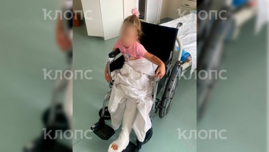 В Калининграде 4-летняя малышка серьезно пострадала из-за наезда подростка на самокате 