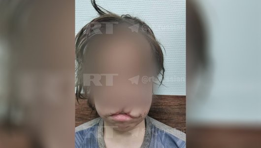 Появились новые данные о здоровье избитого отчимом 12-летнего школьника из Кемеровской области