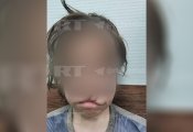 Появились новые данные о здоровье избитого отчимом 12-летнего школьника из Кемеровской области