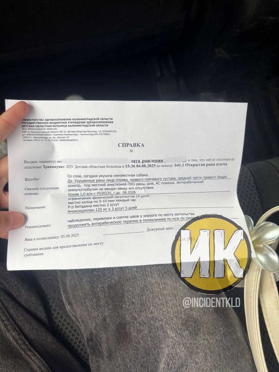 Кадры, от которых сжимается сердце: в Калининграде собака жестоко напала на девочку