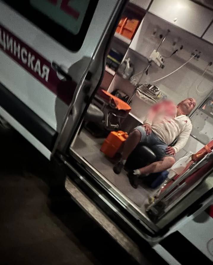 Выезд на природу закончился скорой: медведь напал на татарскую певицу Гульназ Асаеву — есть пострадавший