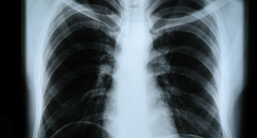 В больнице номер 1 в Янтарном появится рентген-аппарат за 19 млн рублей 