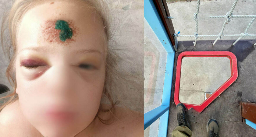 6-летняя девочка получила травмы, упав на новой детской площадке в Калининграде