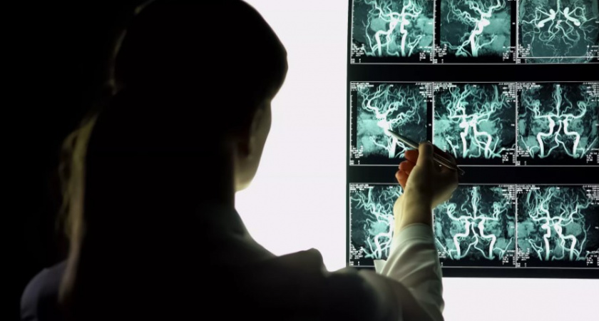 В России разработали очень важный препарат для сплетений сосудов!