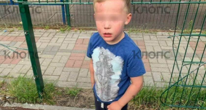Мама бьет тревогу: в Калининграде ребенок травмирован из-за неисправного ограждения площадки