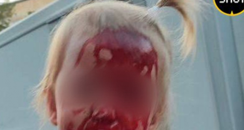 В Крыму подросток на самокате сбила ребенка в коляске. Внимание, очень жесткие кадры (ФОТО 18+, ВИДЕО) 