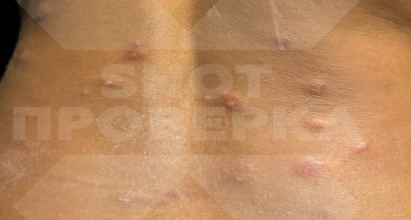 Песчаные паразиты: Невидимая угроза райского отдыха на Мальдивах
