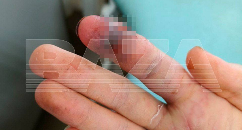 Пытался справиться своими силами, но все же обратился к врачам. В Москве подростка укусила ядовитая змея