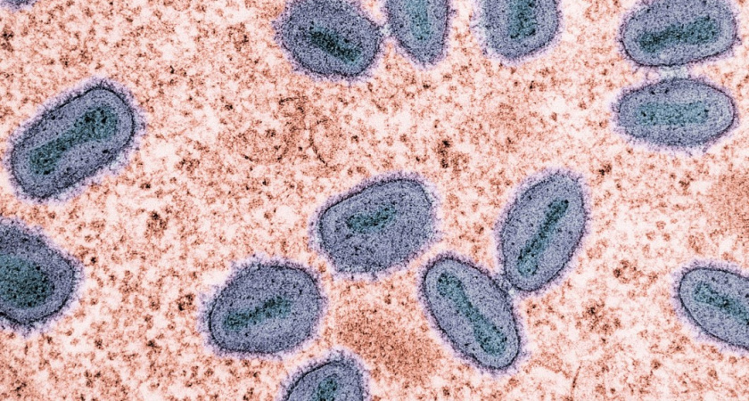 Врач назвал 4 основных места на вашей кухне, где скапливаются бактерии