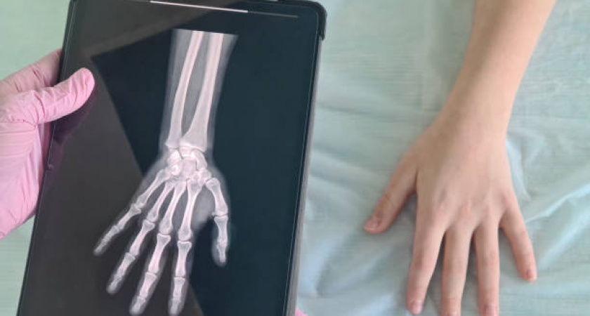 Мама обратилась в суд: из-за чего ребенку пришлось 2 раза ломать руку 