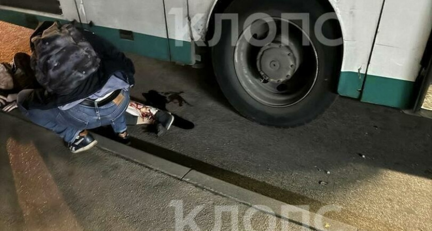 «Кости торчат, ноги ободраны до мяса»Пенсионерка из Калининграда попала под колеса автобуса: жуткие подробности ЧП