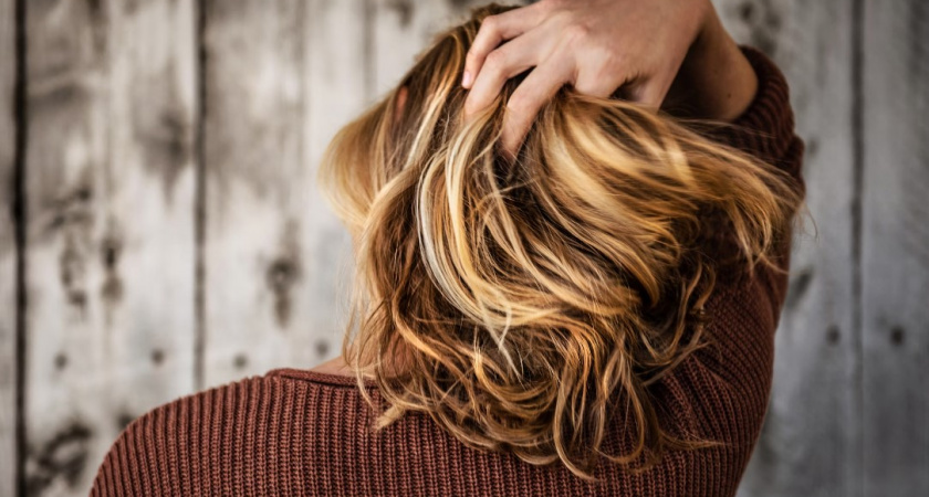 Эпидемия облысения: почему российские женщины массово теряют волосы