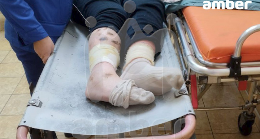 Оставили умирать в больнице: в Гусеве пенсионерка кричала от боли, но врачи не пришли на помощь