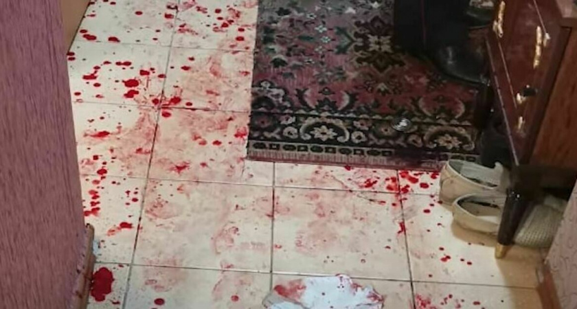 Жуткое нападение в Зеленоградске: как сумасшедший сын едва не убил родную мать