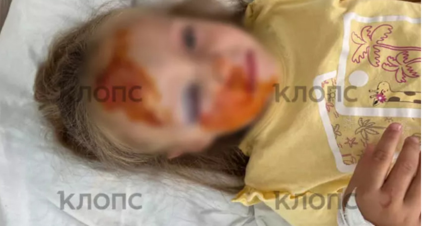 "Ребенок весь в крови!": мать 5-летней девочки, получившей черепно-мозговую травму, рассказала об инциденте в детском саду Советска