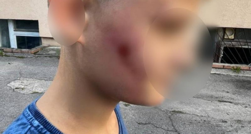 В Зеленоградске мужчина избил ребенка из-за водяного пистолета
