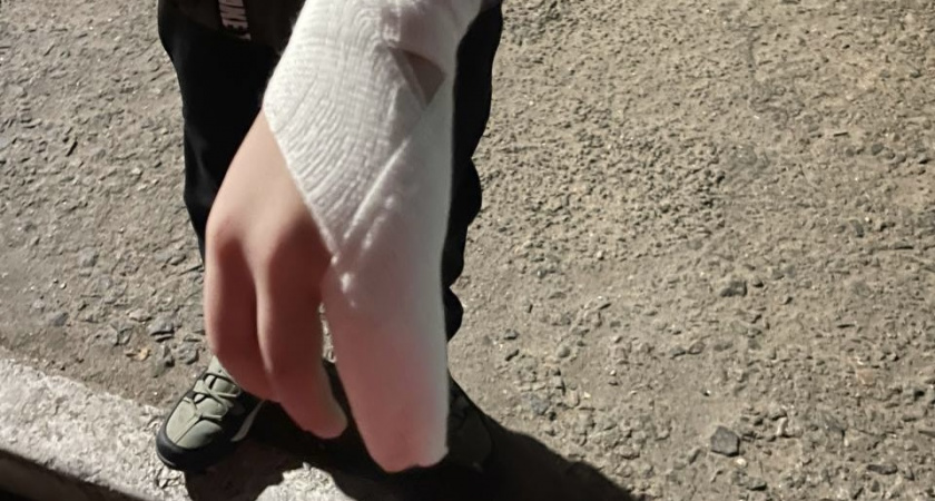 Любопытство оказалось сильнее осторожности: новогодняя петарда в Гурьевске привела подростка на больничную койку