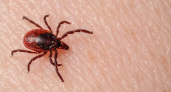 В Калининграде 5985 жителей пострадали от клещей