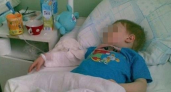«Это все из-за психологического состояния». Родственники ребенка из Москвы, об которого тушили сигареты, не хотят брать ответственность