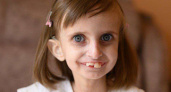 Не упустить шанс: в Калининграде собирают средства, чтобы девочка с редкой болезнью смогла слышать