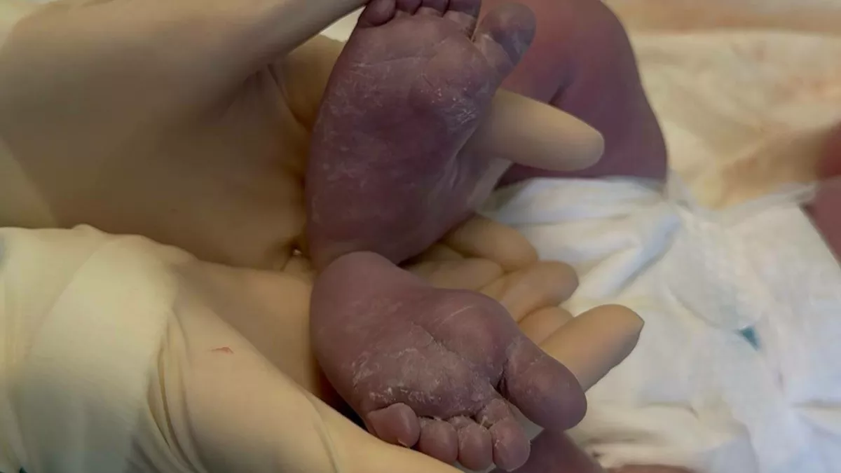 В Калининграде врачи провели уникальную операцию женщине, родившей седьмого ребёнка 