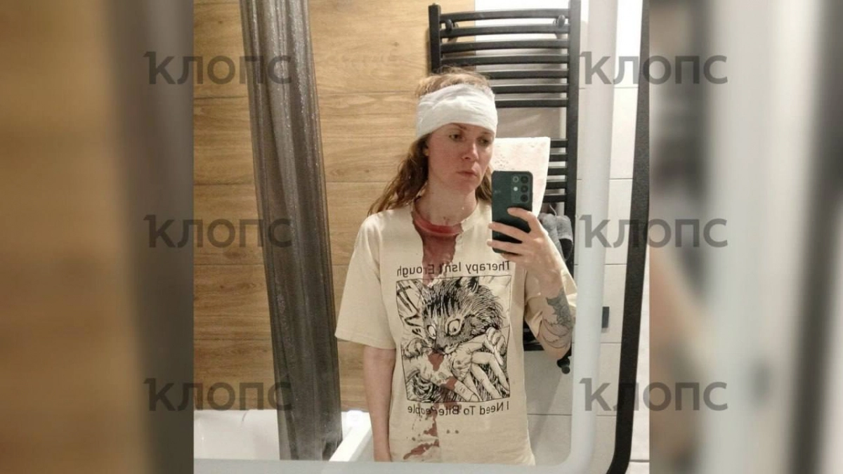 «Провалилась в кроличью нору»: туристка получила травмы на лестнице променада в Зеленоградске