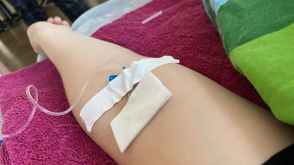 Стеклянная дверь отправила на операционный стол: в Калининграде женщина получила тяжёлую травму руки